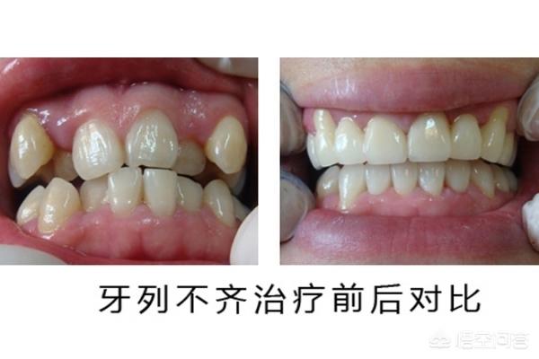 武义县最新24小时牙医在线咨询方法分析(最方便真实的武义县有没有24小时牙医方法)