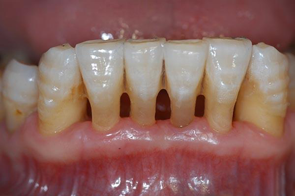 武义县最新24小时牙医在线咨询方法分析(最方便真实的武义县有没有24小时牙医方法)